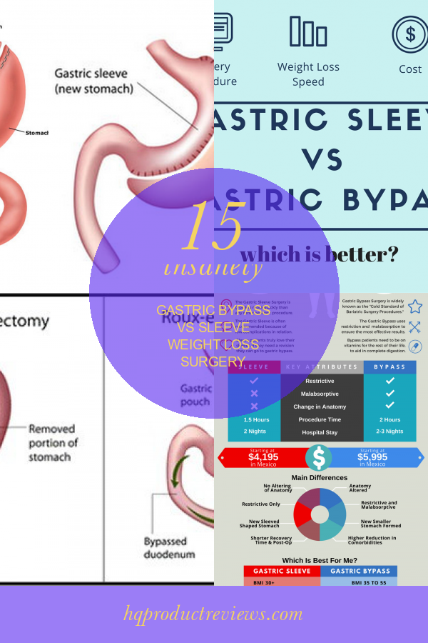 15 Insanely Gastric bypass Vs Sleeve Weight Loss Surgery Best Product